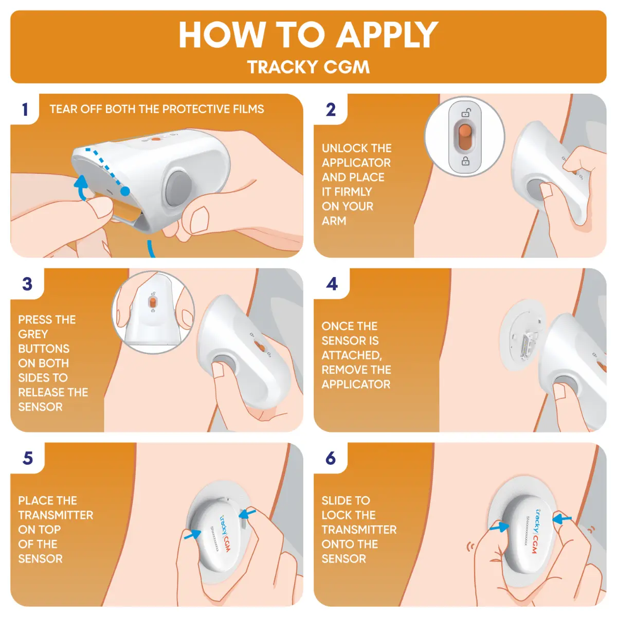 Tracky CGM sensor and applicator